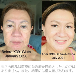 before/after photo